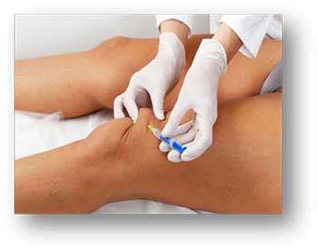 PRP Injections Weston FL